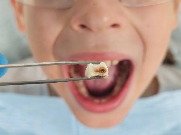 Best Urgent Tooth Repair  in Vienna, WV